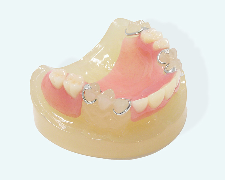 新横浜クルーズ歯科の入れ歯治療