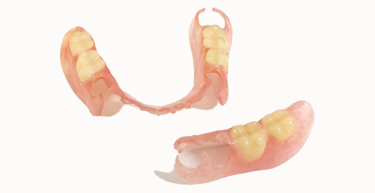 ノンスクラプデンチャー